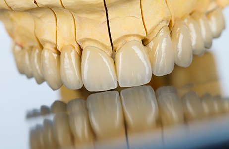 Próteses dentárias na clínica Dentakademi