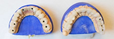 Modelo de dentes artificiais
